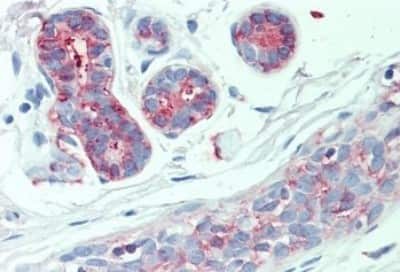 Immunohistochemistry-Paraffin: AE2 Antibody [NBP3-14535]